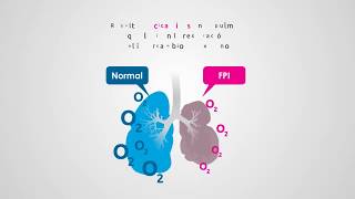 Fibrosis Pulmonar Idiopática FPI  Infografía Animada [upl. by Hurless]