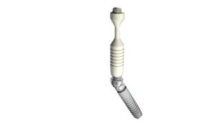 Ankylos® SmartFix – Prosthetic solution on tilted implants  Dentsply Sirona [upl. by Ruphina]