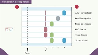 Hemoglobin electrophoresis [upl. by Ecirtnahs470]