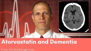 Atorvastatin and Dementia Do atorvastatin and other statins cause dementia and memory loss [upl. by Nylaf]