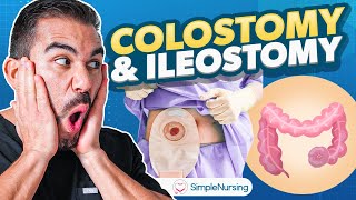 Colostomy and Ileostomy Nursing  Indications Complications Care EASY [upl. by Leafar]