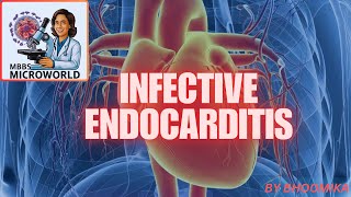 INFECTIVE ENDOCARDITIS [upl. by Lalaj]