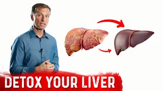 A Surprising Way To Cleanse Fatty Liver – Dr Berg On Liver Detoxification [upl. by Atteuqal]