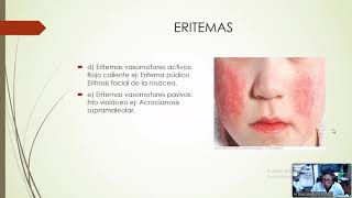 DERMATOSIS MACULARES  DERMATOLOGÍA [upl. by Hanah]