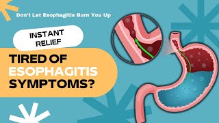 Ease Your Esophagus 5 Effective Natural Remedies for Esophagitis [upl. by Laszlo]