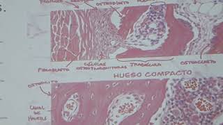 Patología osteoarticular [upl. by Syverson]