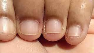 How To Remove Bad Cuticles AtHome In Only 5 Minutes [upl. by Pantin462]