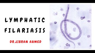 LYMPHATIC FILARIASIS II INFECTIONS II SIMPLY PATHOLOGY II POST GRADUATE EDUCATION II [upl. by Nahn]