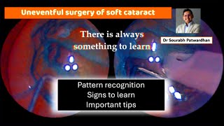 259 uneventful case reallymany tips to learn cigar sign avoiding PCR Dr Sourabh Patwardhan [upl. by Igor943]