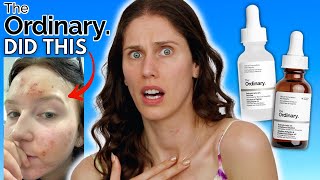 WHAT HAPPENED TO THE ORDINARYS SALICYLIC ACID VS THE NEW SALICYLIC ACID ANHYDROUS SOLUTION [upl. by Mcafee]