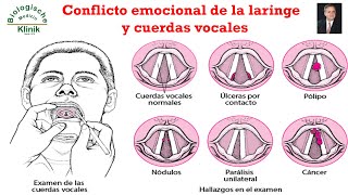 Causa Emocional de Laringitis y Cuerdas Vocales Dr Jorge Coutiño Hdz [upl. by Fancy]