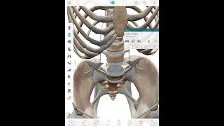 L5S1 Disc Protrusion [upl. by Viveca]