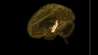 3D Brain from MRI 7 Hippocampus [upl. by Metcalf515]