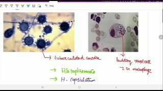 Systemic mycoses  Microbiology  Image based discussion [upl. by Ainnos]