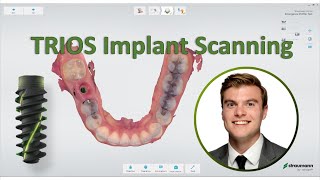 3shape TRIOS  Straumann Implant Scanning Workflow [upl. by Inoue]