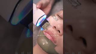 Lets recharge her face today immersiveskincare removeblackheads blackheads velvethair asmr [upl. by Yasui426]