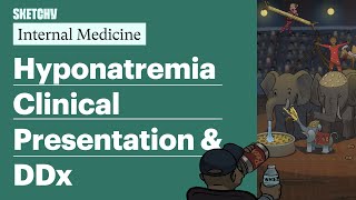 Hyponatremia Clinical Presentation amp DDx Internal Medicine  Sketchy Medical [upl. by Adnovaj]