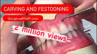 Wax up carving and festooning waxbae dentures [upl. by Kirwin306]