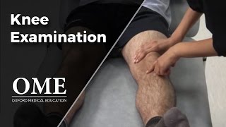 Knee Examination  Orthopaedics [upl. by Noraj]