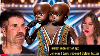 Conjoined twins received Golden Buzzer no one could hold back their tears [upl. by Elihu]