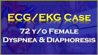 ECGEKG Case 72 Year Old Female Dyspnea and Diaphoresis [upl. by Lleinad]