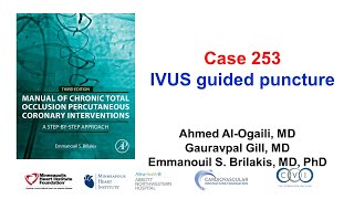 Case 253 Manual of CTO PCI  IVUS guided puncture [upl. by Basil507]