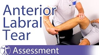 Anterior Labral Tear Test⎟Labral Tear [upl. by Ellenaej]