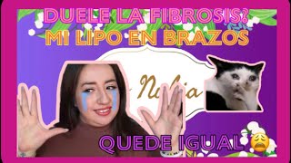 MI Lipo en Brazos  Por que no había hablado de mis resultados  Quede igual [upl. by Chilson]