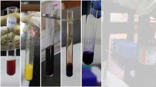 Qualitative Analysis of Amino Acids  Amrita University [upl. by Chun]