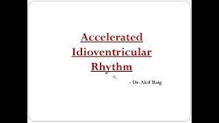 Accelerated Idioventricular Rhythm AIVR Dr Akif Baig [upl. by Mutua]