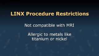 New LINX Procedure for GERD Heartburn Sufferers [upl. by Myrwyn]