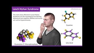 INBORN ERRORS OF NUCLEIC ACID METABOLISM  LESCH–NYHAN SYNDROME [upl. by Elmore887]