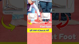 😱पैरों का एसे रखे ख्याल💕💯❤️ shorts viralvideo [upl. by Aem]