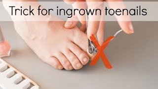 How to Fix Ingrown Toenails Easily [upl. by Ikir]