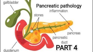 Pancreas pathology acute pancreatitis pathology git pancreas [upl. by Luciano]