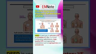 Double Sequential External Defibrillation DSED doctor medical ems [upl. by Cynth]