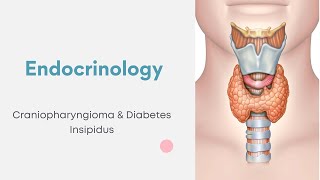 Endocrinology  Craniopharyngioma amp Diabetes Insipidus [upl. by Gilman704]