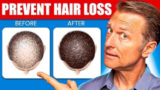 12 Proven Remedies to Prevent Hair Loss and Regrowth Regrow hair [upl. by Theurich536]