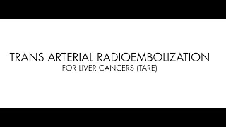 Radioembolization a cuttingedge treatment for liver cancer at its facility [upl. by Natelson]