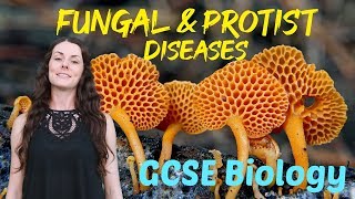 Fungal and protist diseases  GCSE Biology Revision for 2020 [upl. by Seaman]