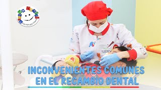 Inconvenientes comunes en el recambio dental [upl. by Nowaj]