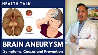 What is Brain Aneurysm Symptoms Causes and Prevention [upl. by Nauq]