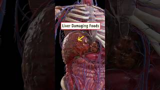 5 Foods Damaging Your Liver ☠️  health liver wellness healthtips shorts [upl. by Donnie]