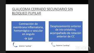 Glaucoma secundario de ángulo cerrado  Dr Rodrigo Rivera [upl. by Nairde]