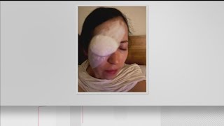 Atlanta Braves respond to lawsuit  Fan alleges Jorge Soler threw ball hurt her eye [upl. by Yelekalb]