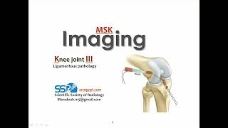 Knee joint imaging ligamentous injuries PT Prof Mamdouh Mahfouz [upl. by Sontich]