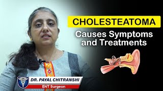 Cholesteatoma Causes Symptoms and Treatments  Middle Ear Infections Treatment  Dr Payal Chitranshi [upl. by Frasch311]