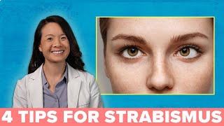 4 Great Ways to Treat Your Strabismus [upl. by Bendicty802]