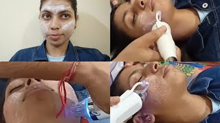 Laser Treatment Of My Face 🧑First Sitting Vlog [upl. by Rozanna]