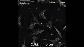 Nuclear Disruption in PreAdipocytes by CDK2 Inhibition [upl. by Ahseiyk]